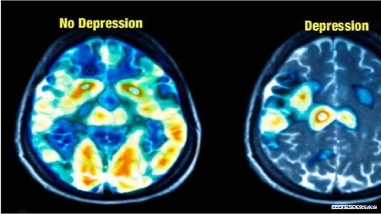 روسيا.. اكتشاف مؤشر بيولوجي على "صحة الدماغ"